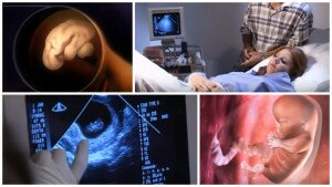 Календарь беременности двенадцатая неделя